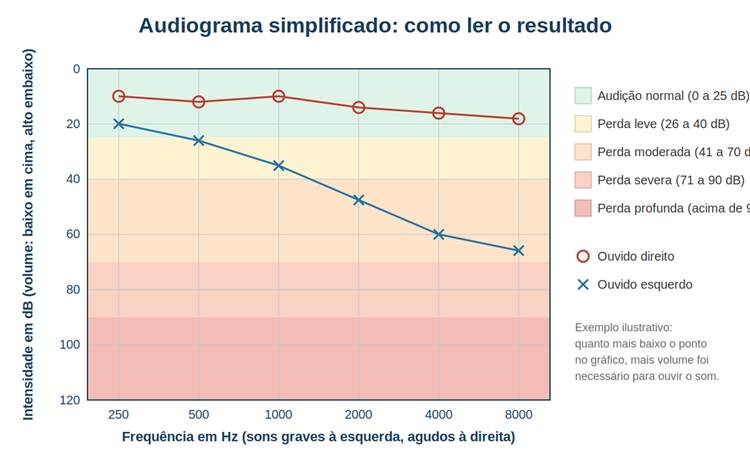 Como entender o resultado: o audiograma